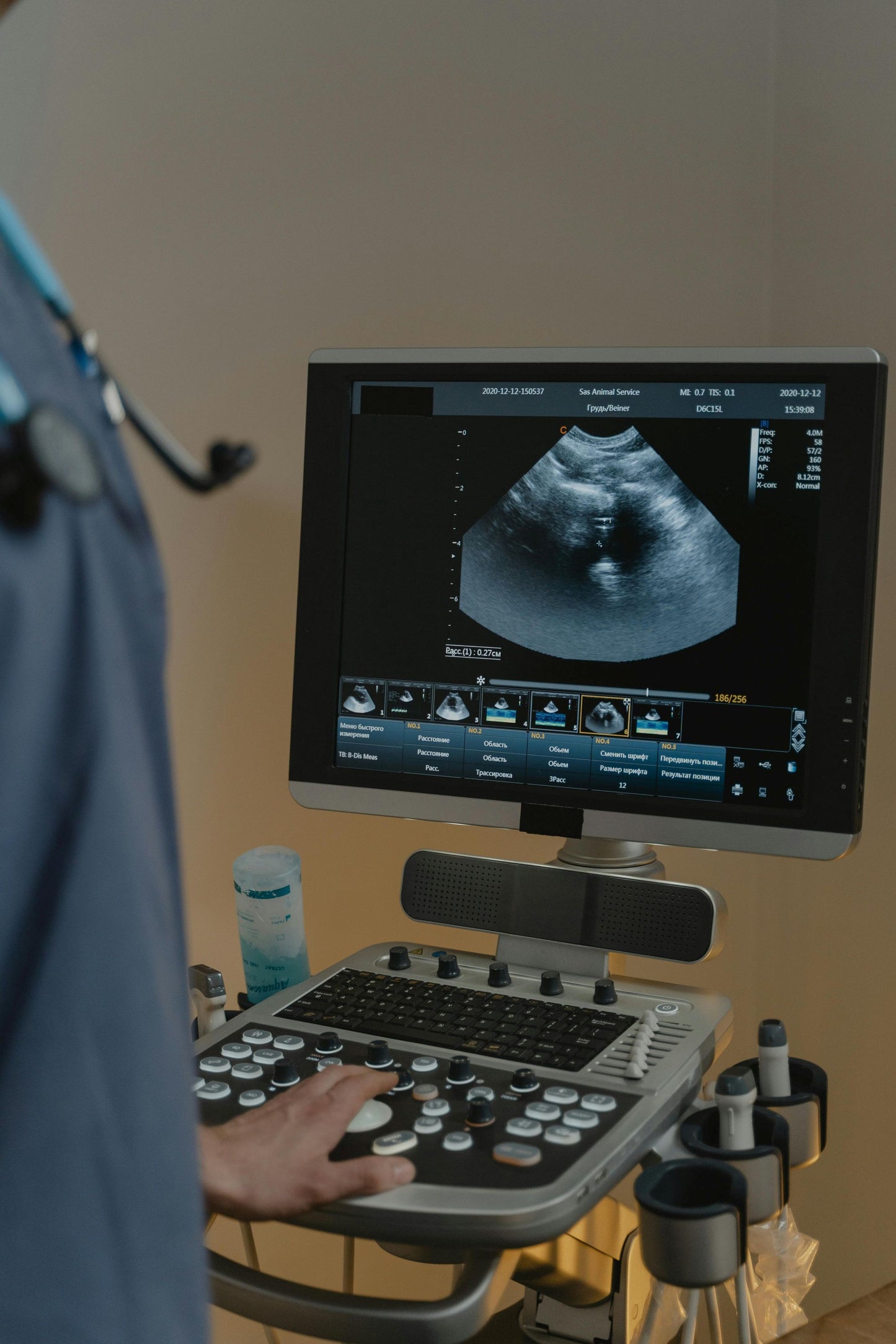 Ultrasound machines